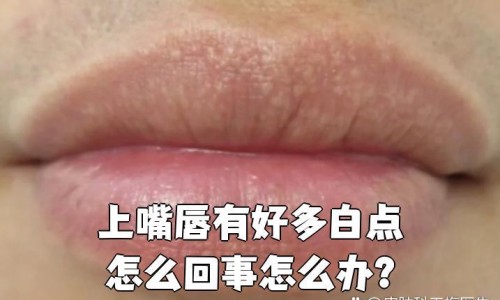 月经期可不可以吃柠檬-柠檬膏月经期间吗网 - 网站提供柠檬膏正确的熬法小常识、月经期可以吃柠檬片吗
